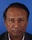 After Hair Transplant &nbsp;Front